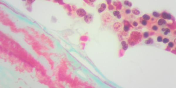 Parafina DMSO (55-58ºC) - mejor infiltración y preservación de tejidos exigentes